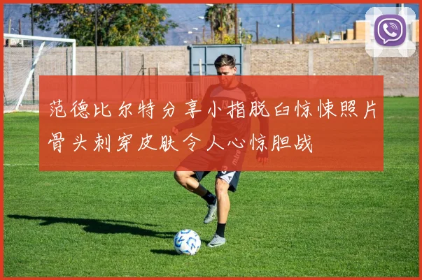 范德比尔特分享小指脱臼惊悚照片骨头刺穿皮肤令人心惊胆战